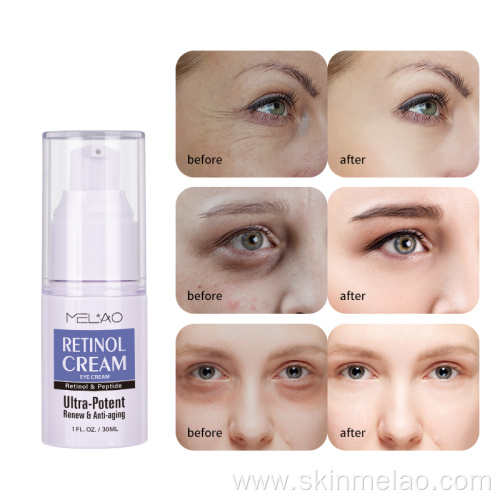 Eye Bag Removal Anti Aging Retinol Eye Cream